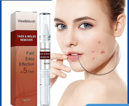Professional Skin Tag & Mole Removal Device – Flawless Skin At Home - Vistora